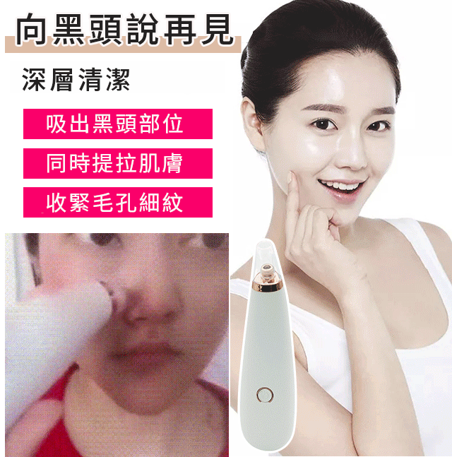 【蝶蓮娜家用吸黑頭神器】黑頭、粉刺、痘痘都不見了，深層清潔，收縮毛孔細紋！