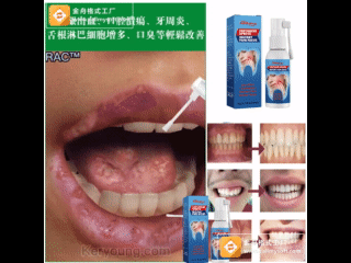 熱賣【牙周炎輕鬆治療】草本精華,專攻牙痛,不拔牙不開刀,一噴止痛,消除牙痛/牙周炎/牙齦腫痛等口腔問題 熱賣【牙周炎輕鬆治療】草本精華,專攻牙痛,不拔牙不開刀,一噴止痛,消除牙痛/牙周炎/牙齦腫痛等口腔問題