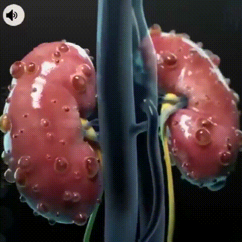 1702642052960325.gif 1.gif